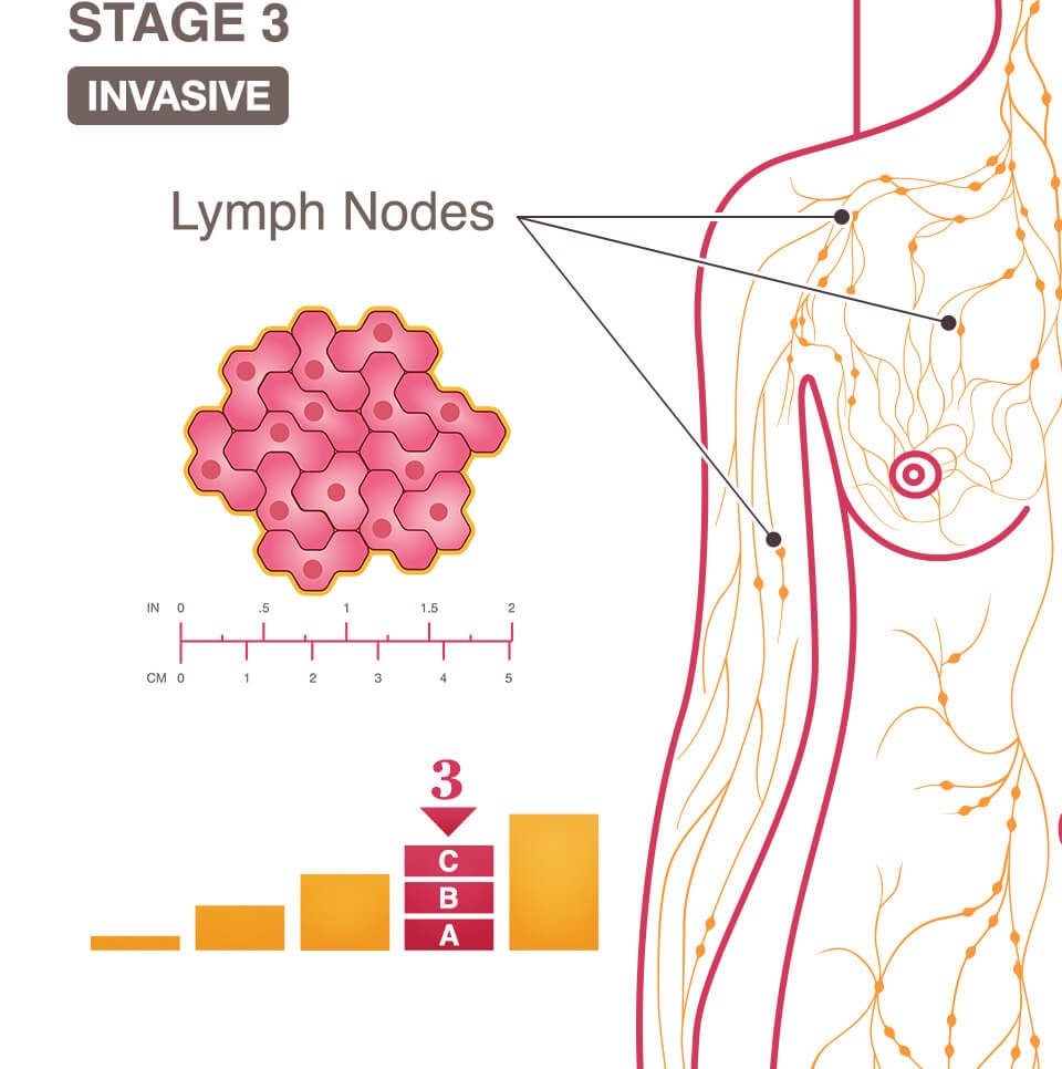 Illustration of breast lymph nodes in a female body