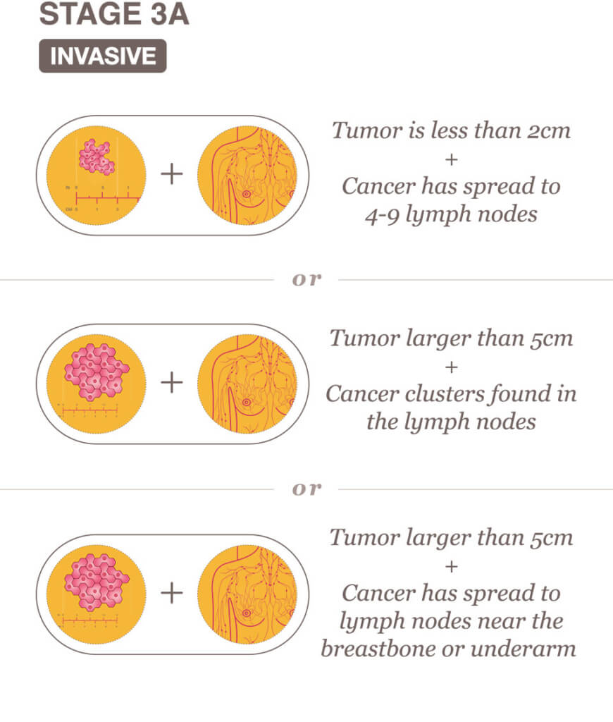 Stage 3a breast cancer visual descriptions